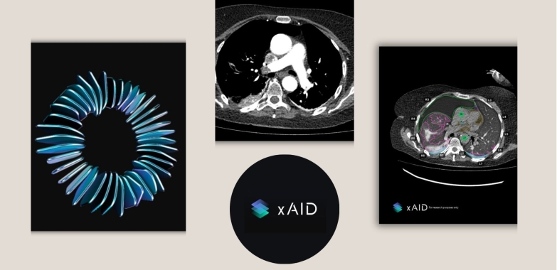 Discovering xaid.ai for Smarter AI Radiology Workflows